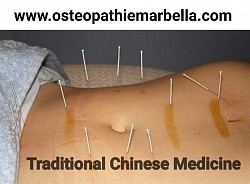 Trata el dolor con acupunctura